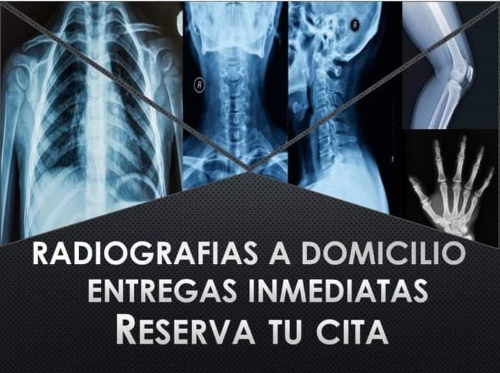 RADIOGRAFIAS A DOMICILIO